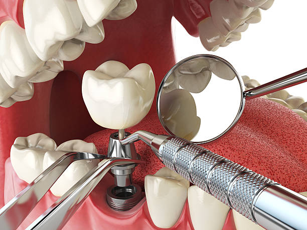 Dentist for Dental Trauma in WV